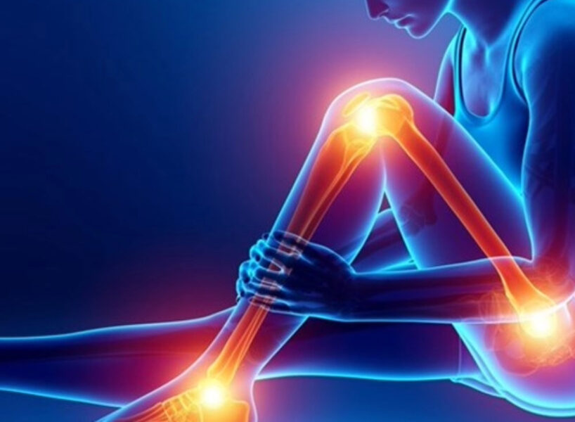 arthritis pain